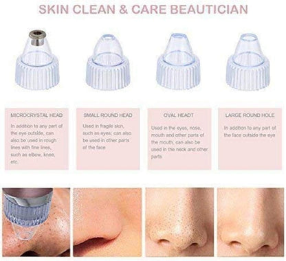 DermaSuction™ - Black Head Remover Pore Cleaning Device